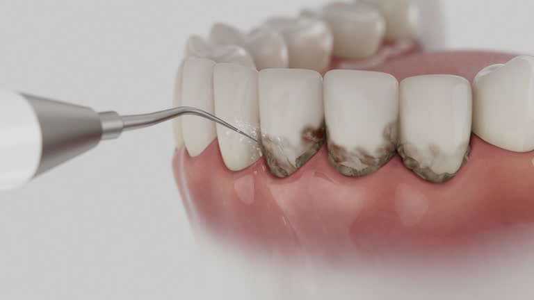 Trusted Tooth Extraction service in Algonquin, MD - Dentist Open Now